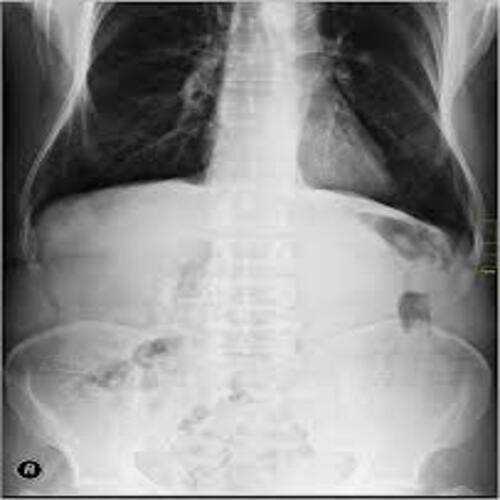 Med-Img